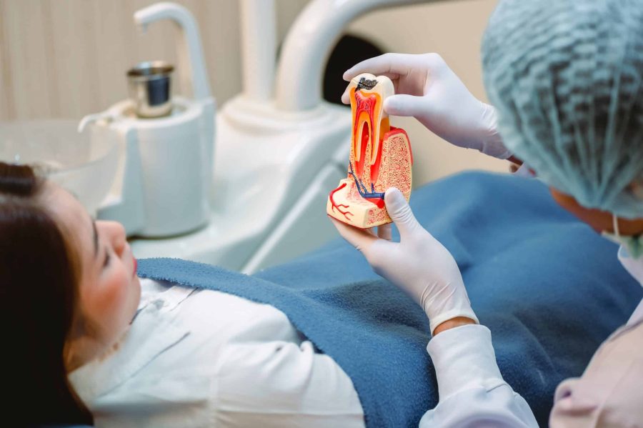 Root Canals in Waco