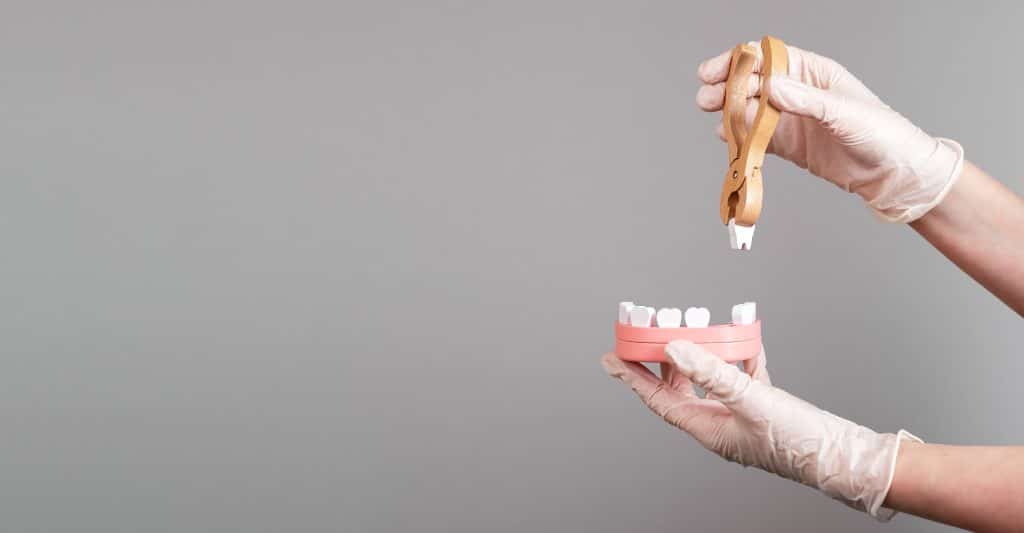 Tooth Extractions Waco