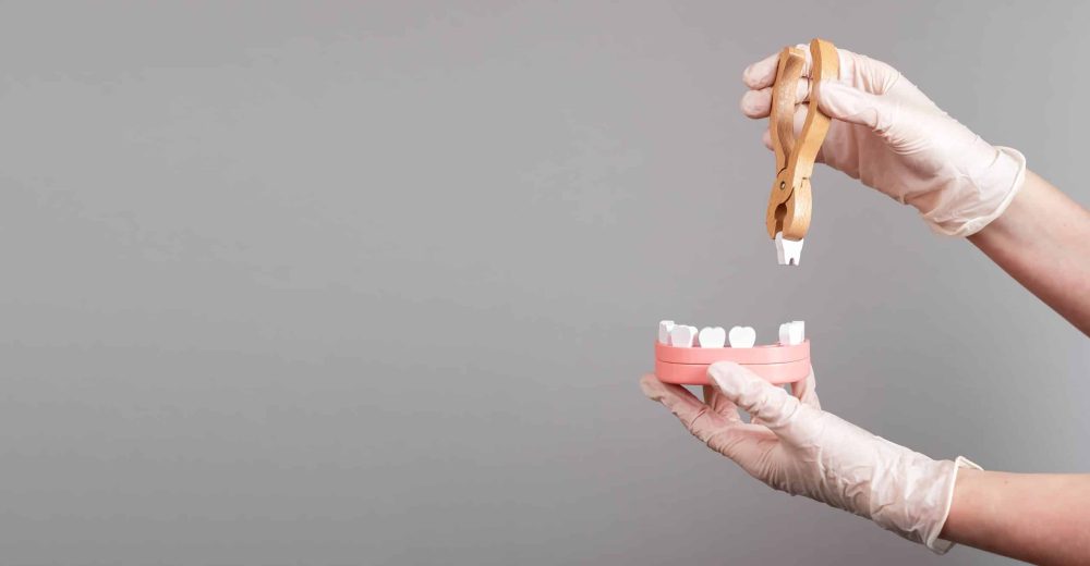 Tooth Extractions Waco