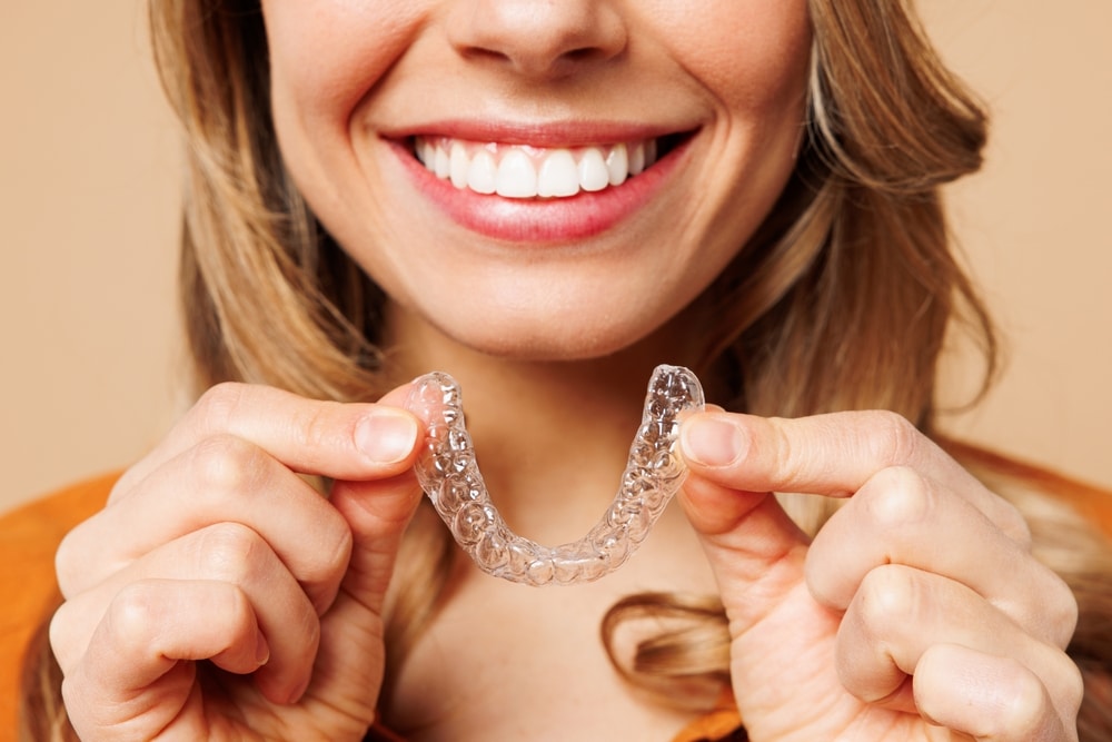 invisible aligners